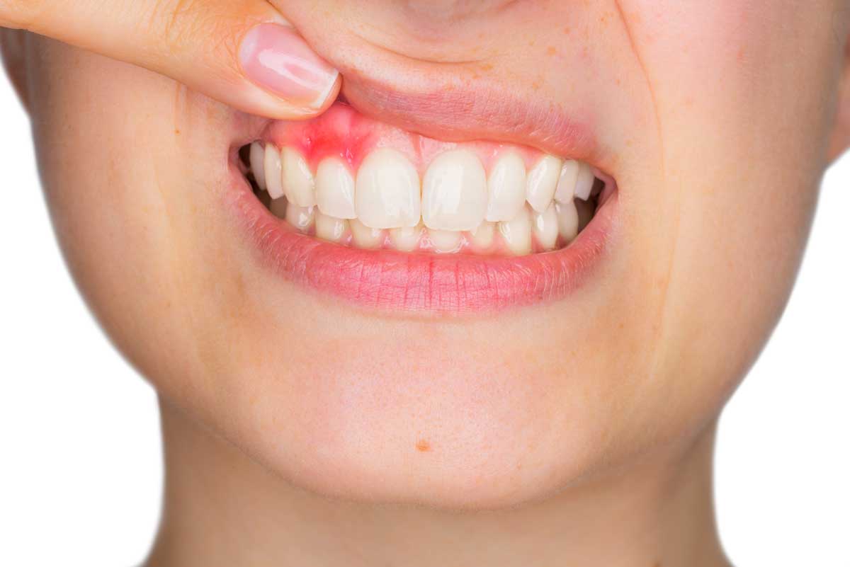 Zahnarztpraxis in Bergneustadt - Parodontitis-Behandlung